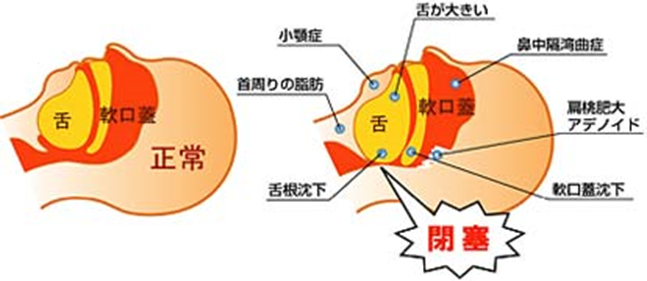 image5 image5