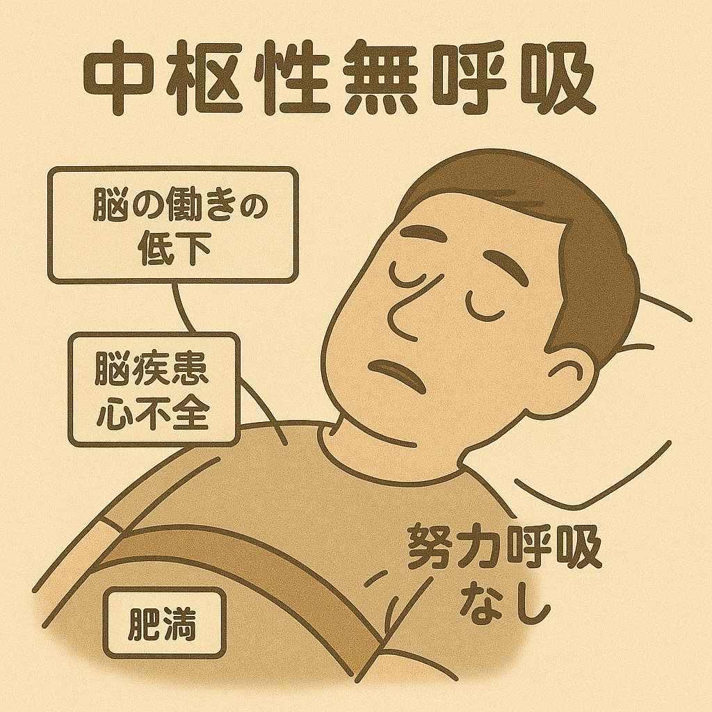 csa 中枢性無呼吸